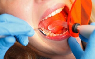 Ricostruzione denti dannegiati, scopri come