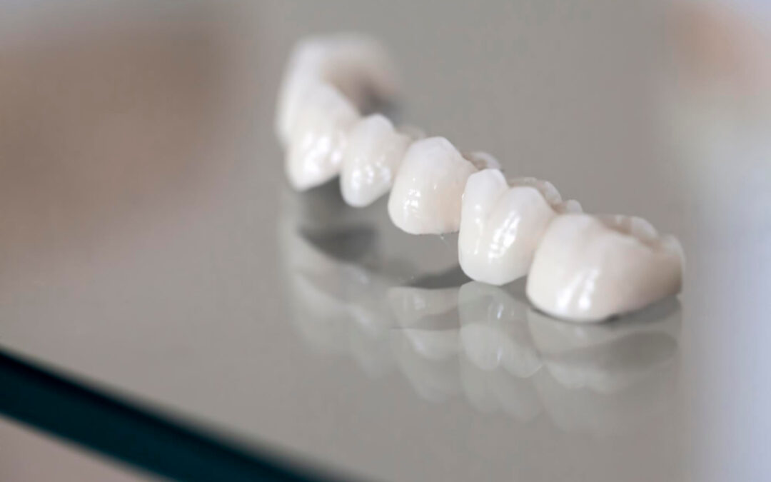 Impianti dentali in ceramica, i più resistenti
