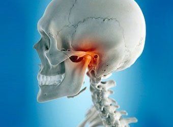 Disfunzione dell’articolazione temporo-mandibolare nei giovani: quando fare una valutazione?