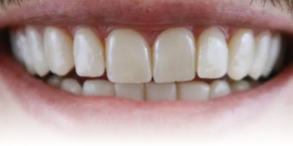 Sorridi senza pensieri – Clinica Dentale Smiledoc - Clinica Dentale Smiledoc Monterotondo